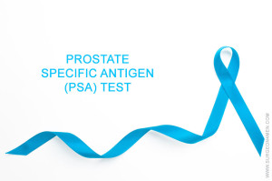 Prostate Specific Antigen (PSA) Test Image