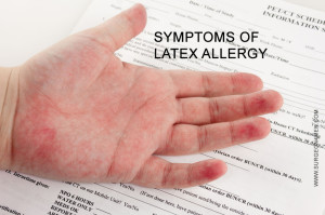 Symptoms of latex allergy image